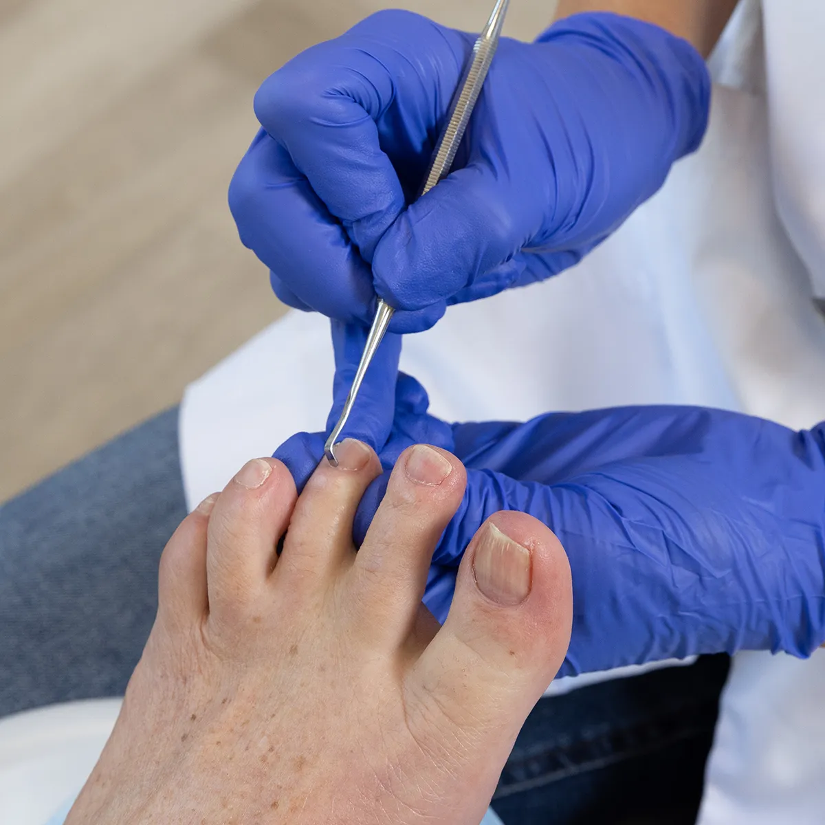 diabetische voet Footprof