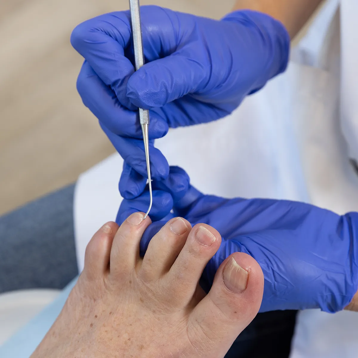 reumatische voet Footprof